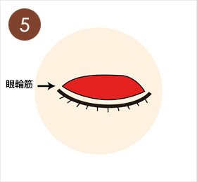 5.皮ふの下の眼輪筋の重たい部分を一部切除する（まぶたを閉じる機能には影響ない）。