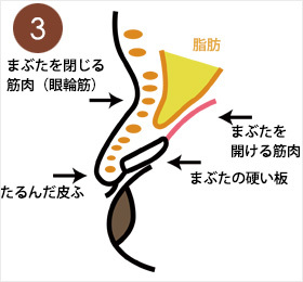 3.まぶたを開ける筋肉は、まぶたの皮ふのさらに深い部分にある。